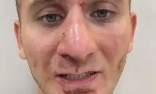 Ekvator’da saldırıya uğradığını paylaşan Türk gezgine Büyükelçilik yardım eli uzattı