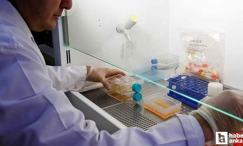 Prostat kanseri, erkeklerde en çok görülen ikinci kanser türü oldu