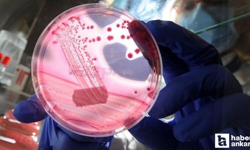 Ailesinde prostat kanseri olanlara meme kanseri uyarısı!