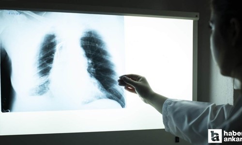 50 yaş üstü sigara tiryakilerine uyarı: Mutlaka yaptırın!