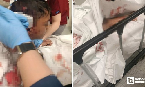 Altındağ'da 8 yaşındaki çocuğa okul dönüşü sokak köpeği saldırısı