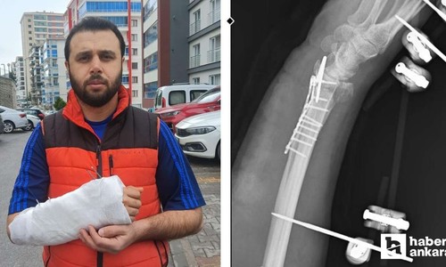 Mamak'ta sahipsiz köpeklerden kaçmaya çalışan adam bileğini kırdı