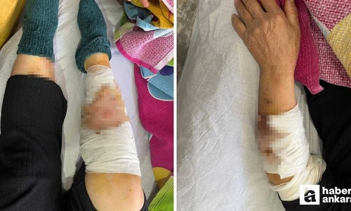 Ayaş'ta köpek saldırısına uğrayan yaşlı kadın ağır yaralandı!