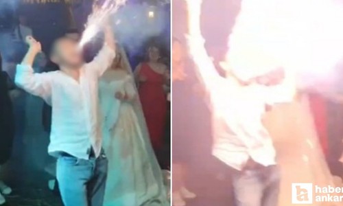 Pursaklar'da düğünde ağzında meşale patlayan genç yüzünden yaralandı