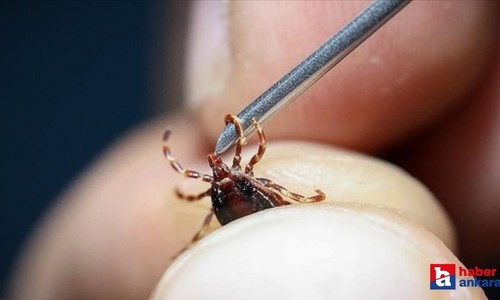 Ankara'da KKKA hastalığı şüphesiyle tedavi gören kişi yaşamını yitirdi