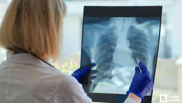 Bu diş rahatsızlığı KOAH ve zatürreye sebep olabiliyor!