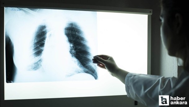 50 yaş üstü sigara tiryakilerine uyarı: Mutlaka yaptırın!