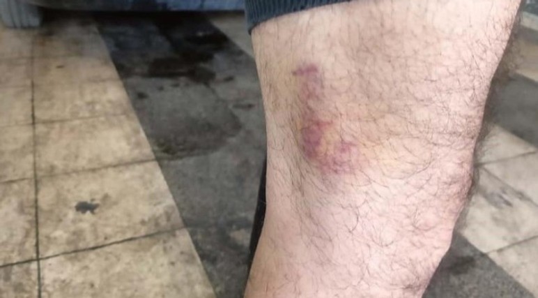 Altındağ'da bir babanın ayırmaya çalıştığı kavga sebebiyle 3 yaşındaki oğlunun yanında darp edildiği iddia edildi