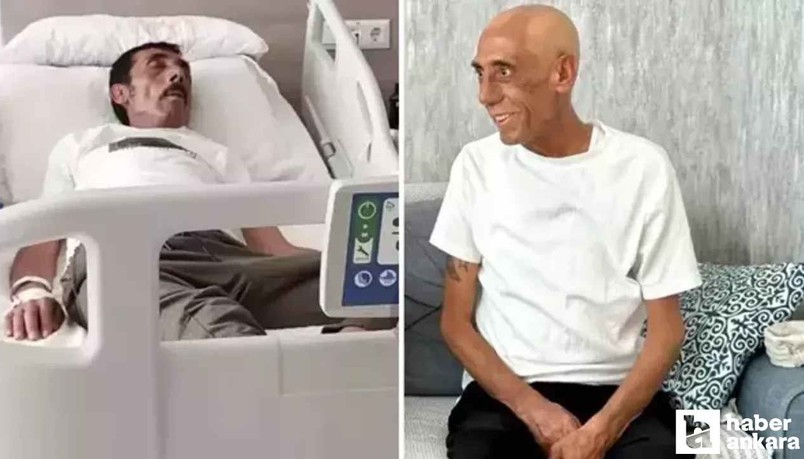 Ankaralı Turgut son sağlık durumu nasıl, öldü mü, entübe edildi ne demek?