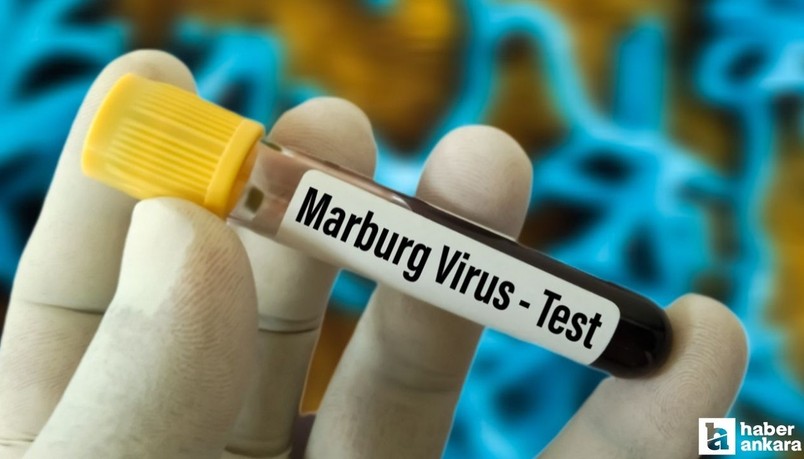 Marburg virüsü 8 kişinin ölümüne sebep oldu: Belirtiler nedir?